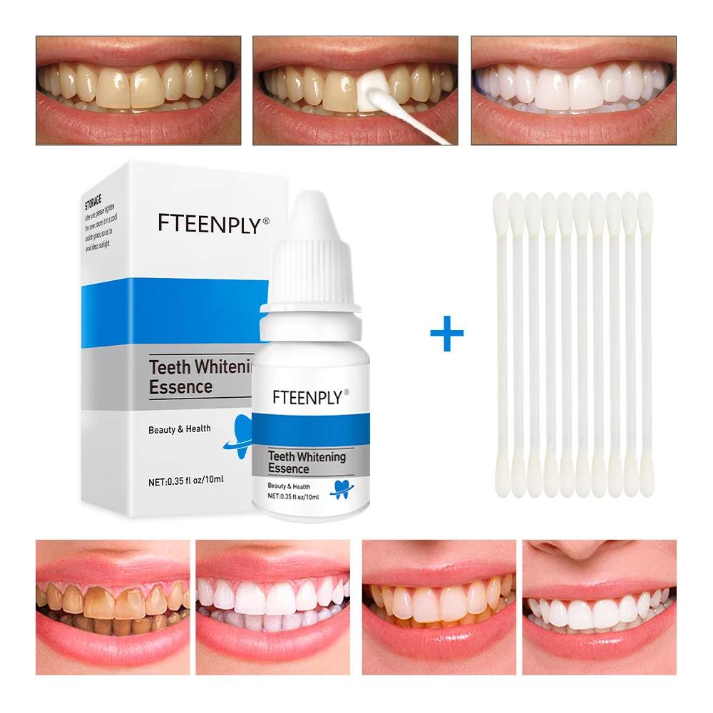 Teeth Whitening Procedure - FTEENPLY Làm Trắng Răng Tinh Chất