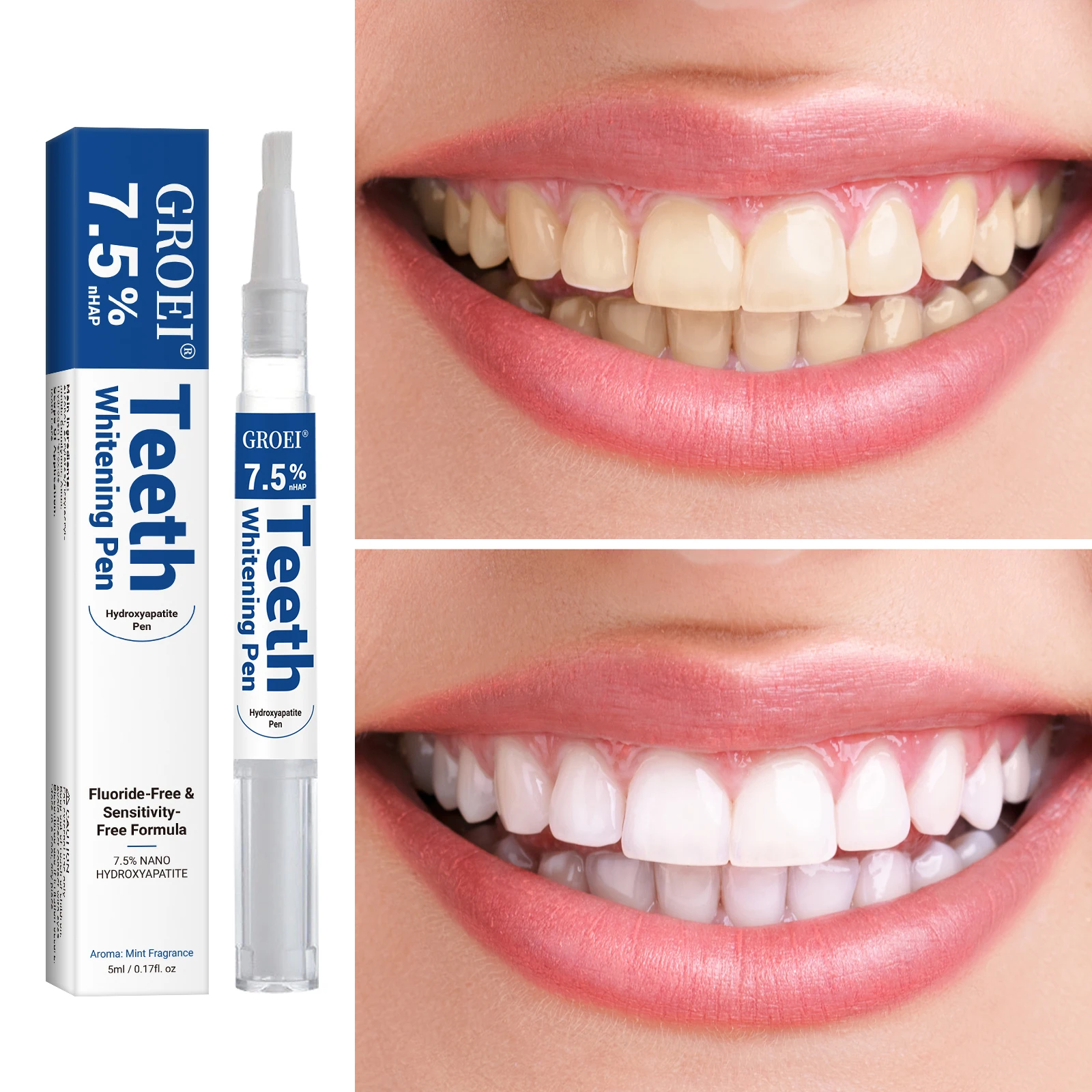 Hydroxyapatite Tooth Whitening - đánh giá và giá Teeth Whitening Procedure