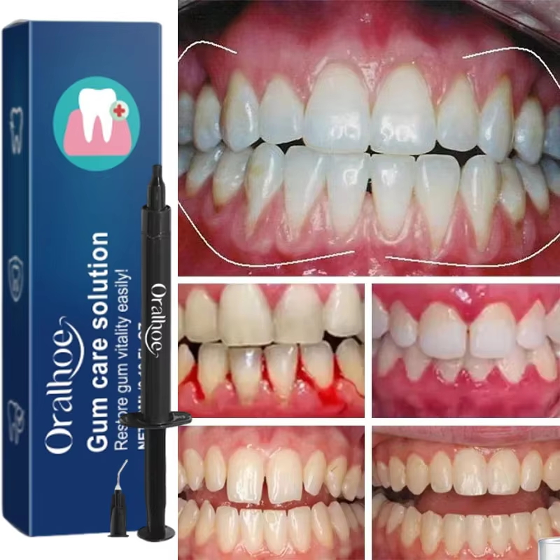 Teeth Whitening Gel Gum Repair - đánh giá và giá Teeth Whitening Gel