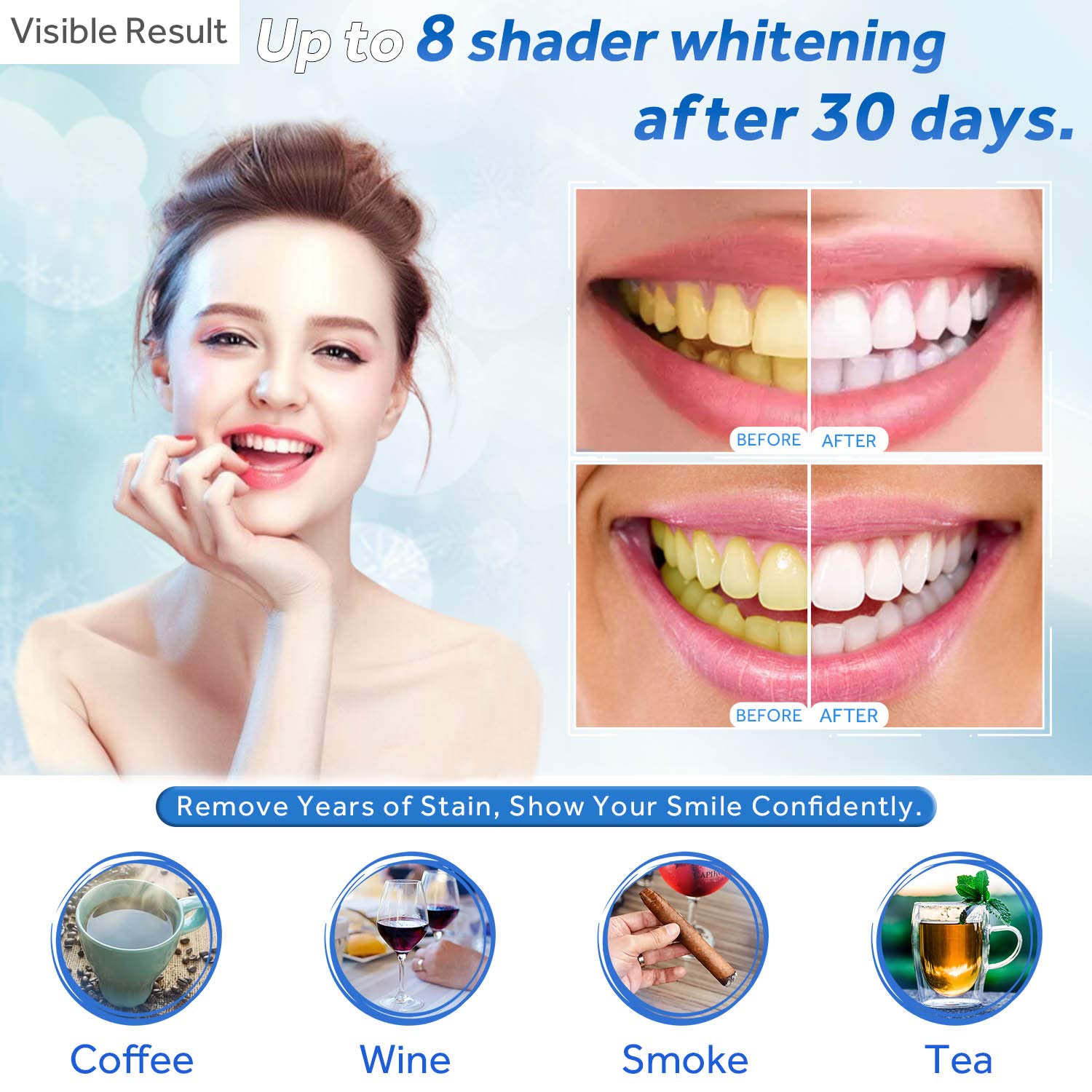 Teeth Whitening Gel Refill Syr - đánh giá và giá Teeth Whitening Procedure