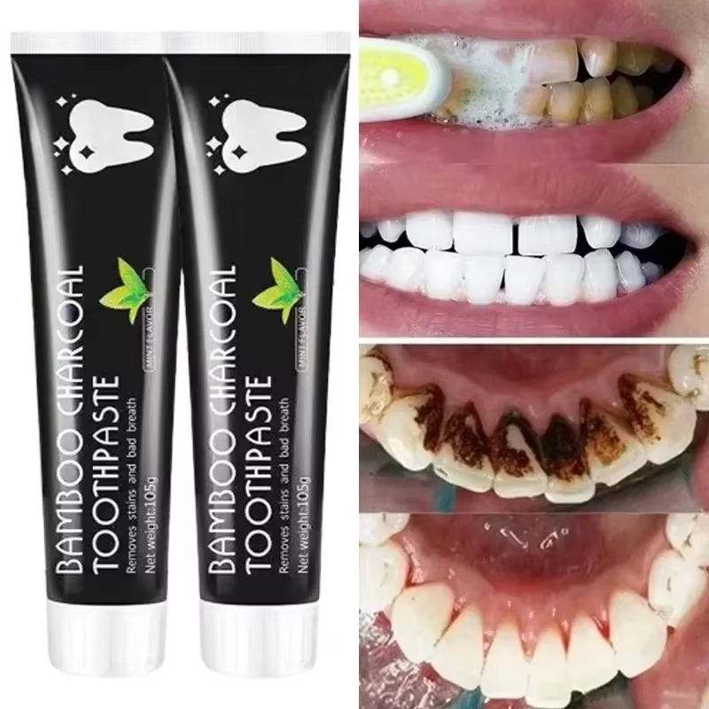 Whitening Toothpaste Bamboo Ch - đánh giá và giá Teeth Whitening At Home