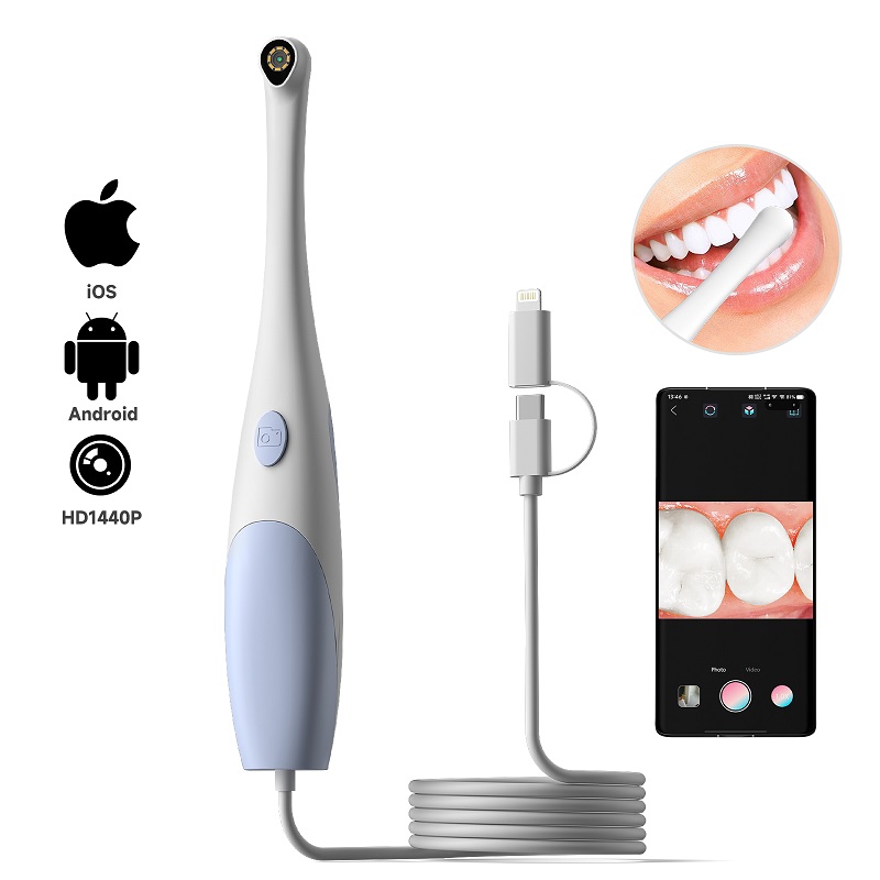 Oral Endoscope Camera 1440P Ph - đánh giá và giá Teeth Whitening Video
