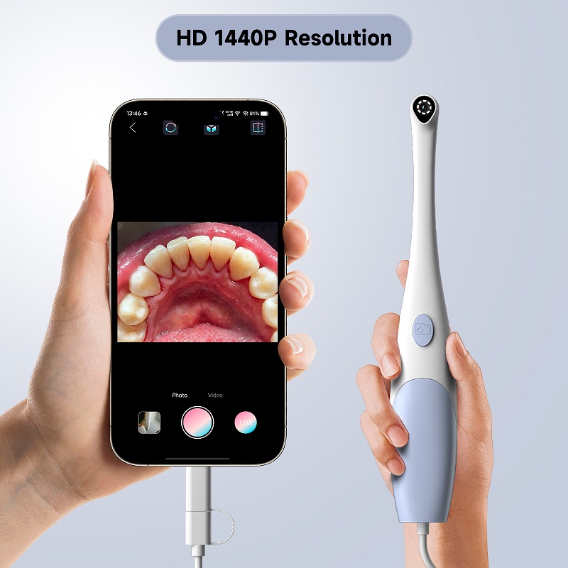 Oral Endoscope Camera 1440P Ph - đánh giá và giá Teeth Whitening Video