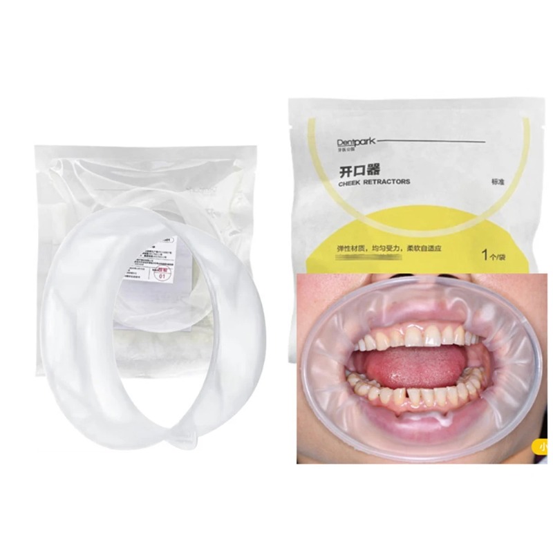 20Pcs Dentpark O-Shape Oral Ch - đánh giá và giá Teeth Whitening Clinic