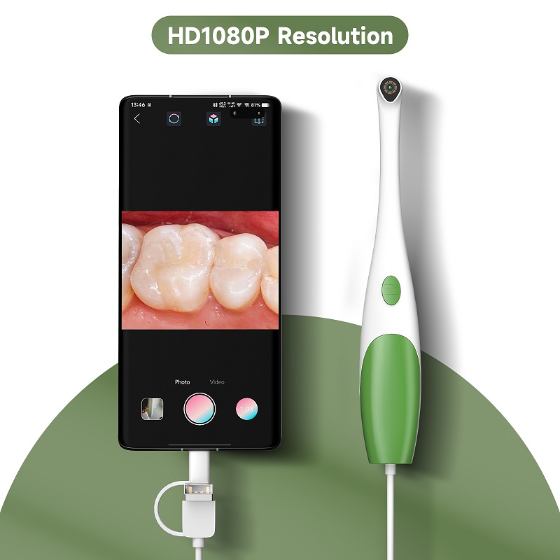 TYPE-C Oral Endoscope Handheld - đánh giá và giá Teeth Whitening Video