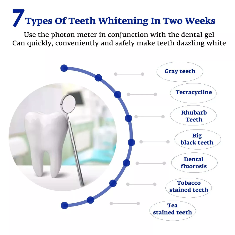 Teeth Whitening Accelerator Sm - đánh giá và giá Teeth Whitening At Home